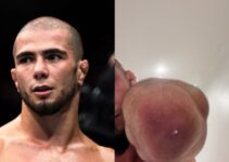 Muhammad Mokaev de l'UFC révèle de graves infections staphylococciques