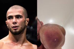 Muhammad Mokaev de l'UFC révèle de graves infections staphylococciques