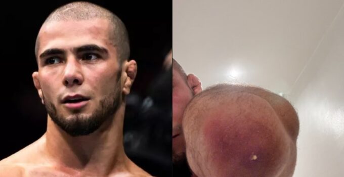 Muhammad Mokaev de l'UFC révèle de graves infections staphylococciques