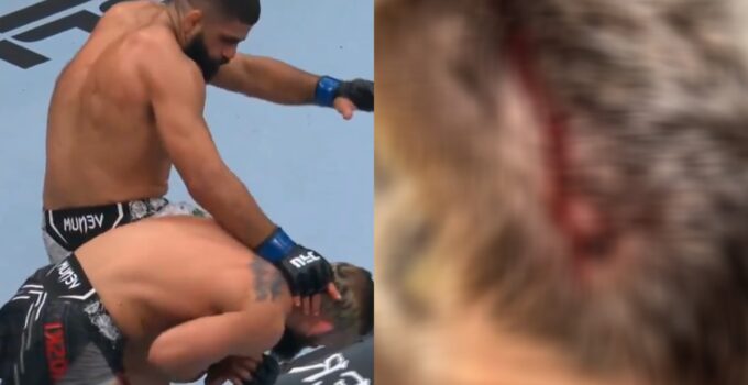 Blessure horrible d'un combattant lors d'un accident UFC
