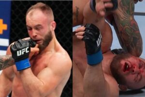 Brésilien défigure adversaire en UFC, hospitalisation