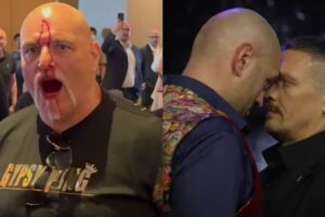 Père de Tyson Fury blessé dans altercation avec clan Usyk