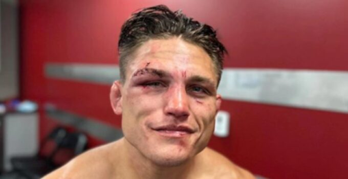 Blessure impressionnante de Drew Dober à l'UFC Denver