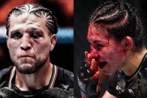 UFC : Deux combattants défigurés, images choquantes