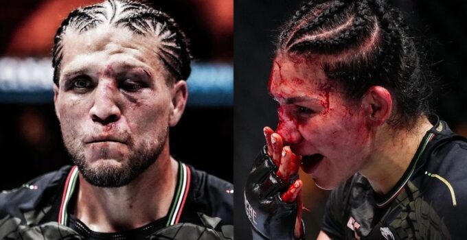 UFC : Deux combattants défigurés, images choquantes